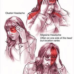 Nocturnal Migraine Bloggers - Prevent A Migraine Headache