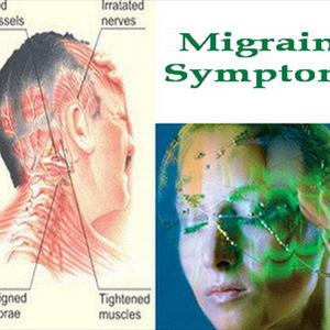 Migraine And Aura - Magnesium May Treat Cluster Migraine Headaches