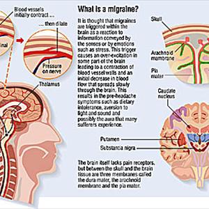 New Migraine Surgery - Migraine Headaches Hurt! Get Help!